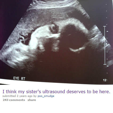 Ultrasound